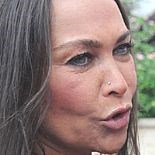 HÜLYA AVŞAR´A ESTETİK YASAĞI